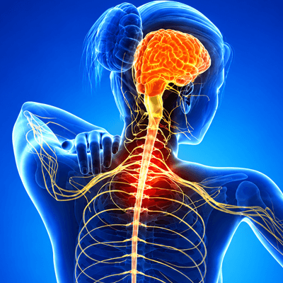 Multiple Sclerosis & Demyelinating Disorders
