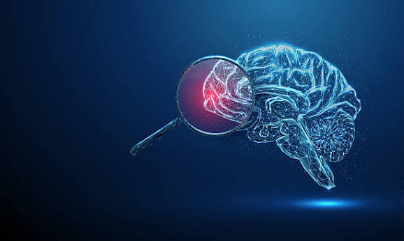 Best Brain Aneurysm Coiling Specialist in Vile Parle